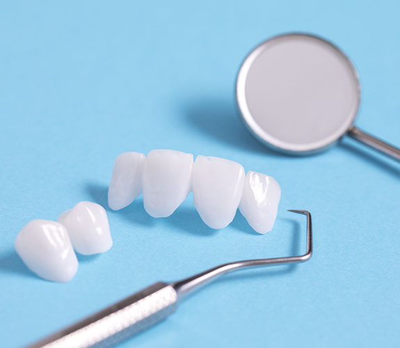 Set of metal free dental restorations on table