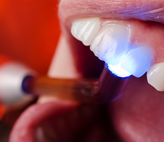 Patient receiving cosmetic dental bonding