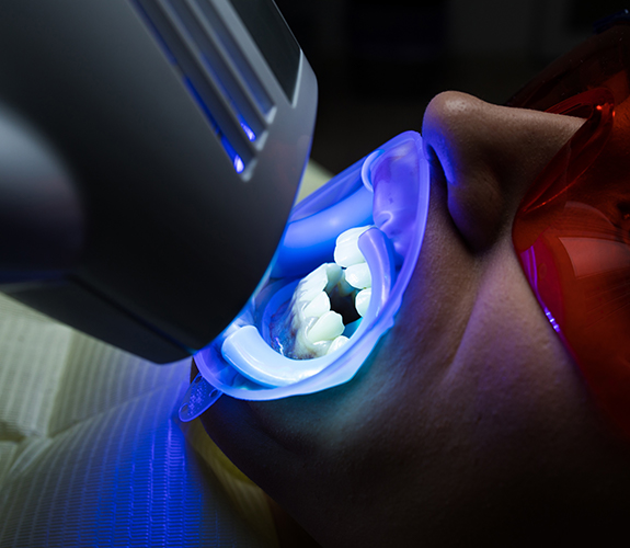 Man receiving teeth whitening treatment