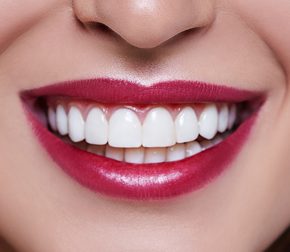 Closeup of smile after gum recontouring 