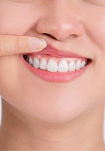 a person showing their healthy gums