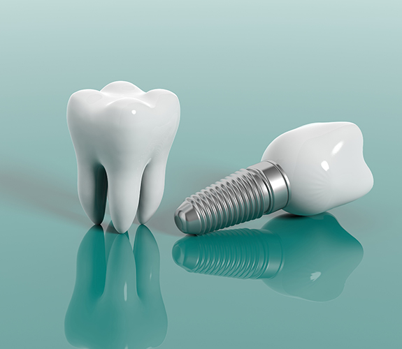 Animated tooth and dental implant supported dental crown