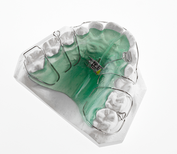 Closeup of expander appliance on model smile