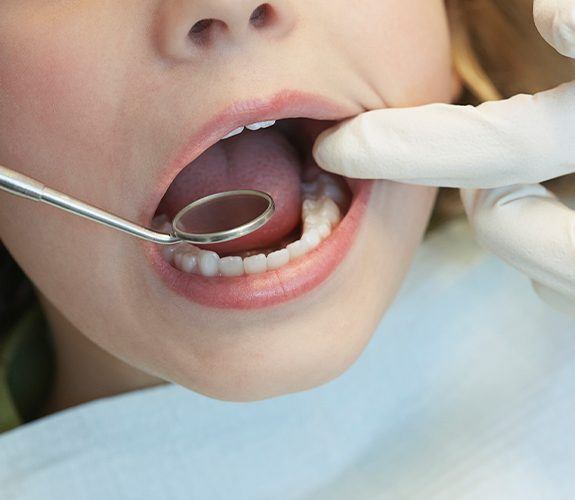 Preteen girl smiling after pulp therapy