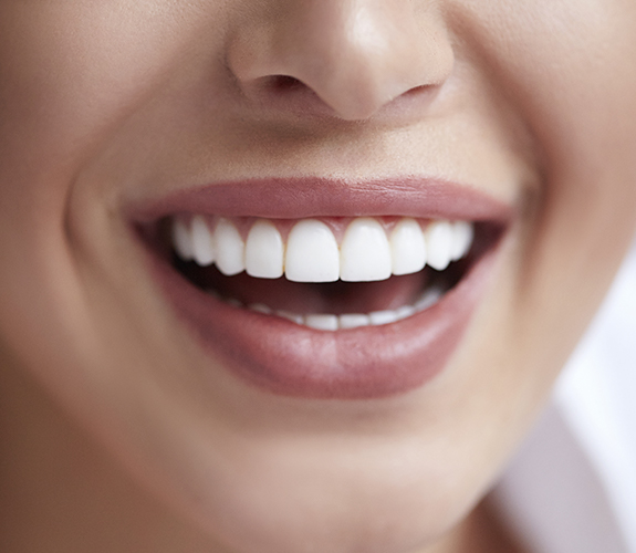 Woman's healthy smile after fluoride treatment