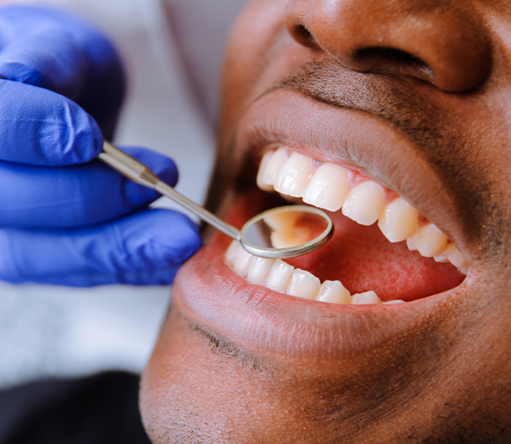 Dentist checking patient's restorative dentistry tooth colored filling treatment