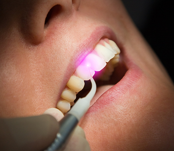 Patient receiving soft tissue laser dentistry treatment