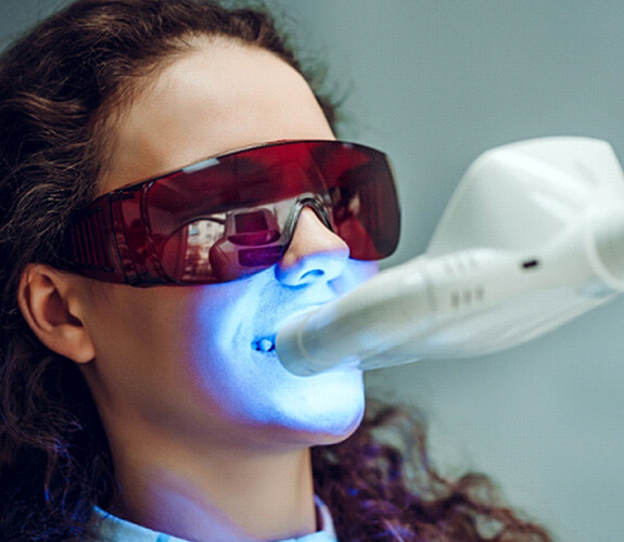 in-office teeth whitening