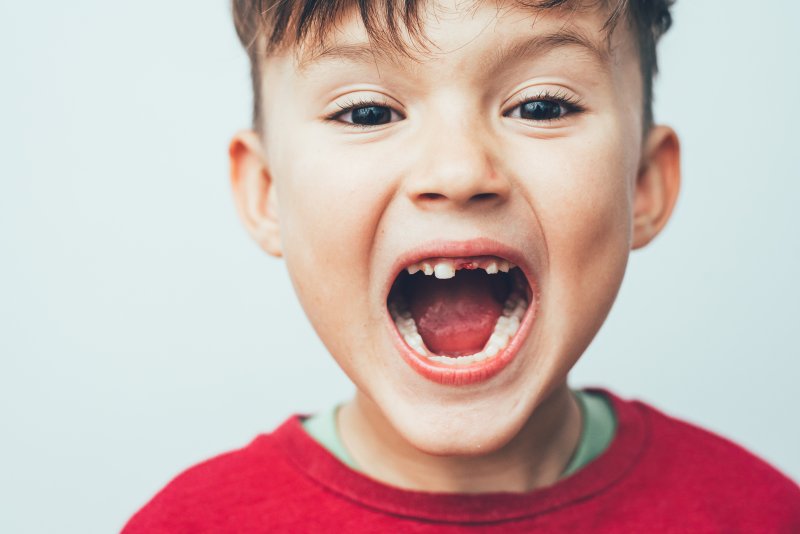 child with knocked-out tooth